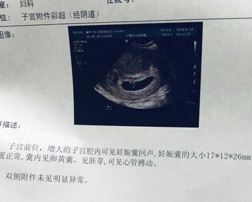 国内供卵最好的医院,去福州哪里做试管婴儿好？哪家医院可靠，能帮你圆梦？